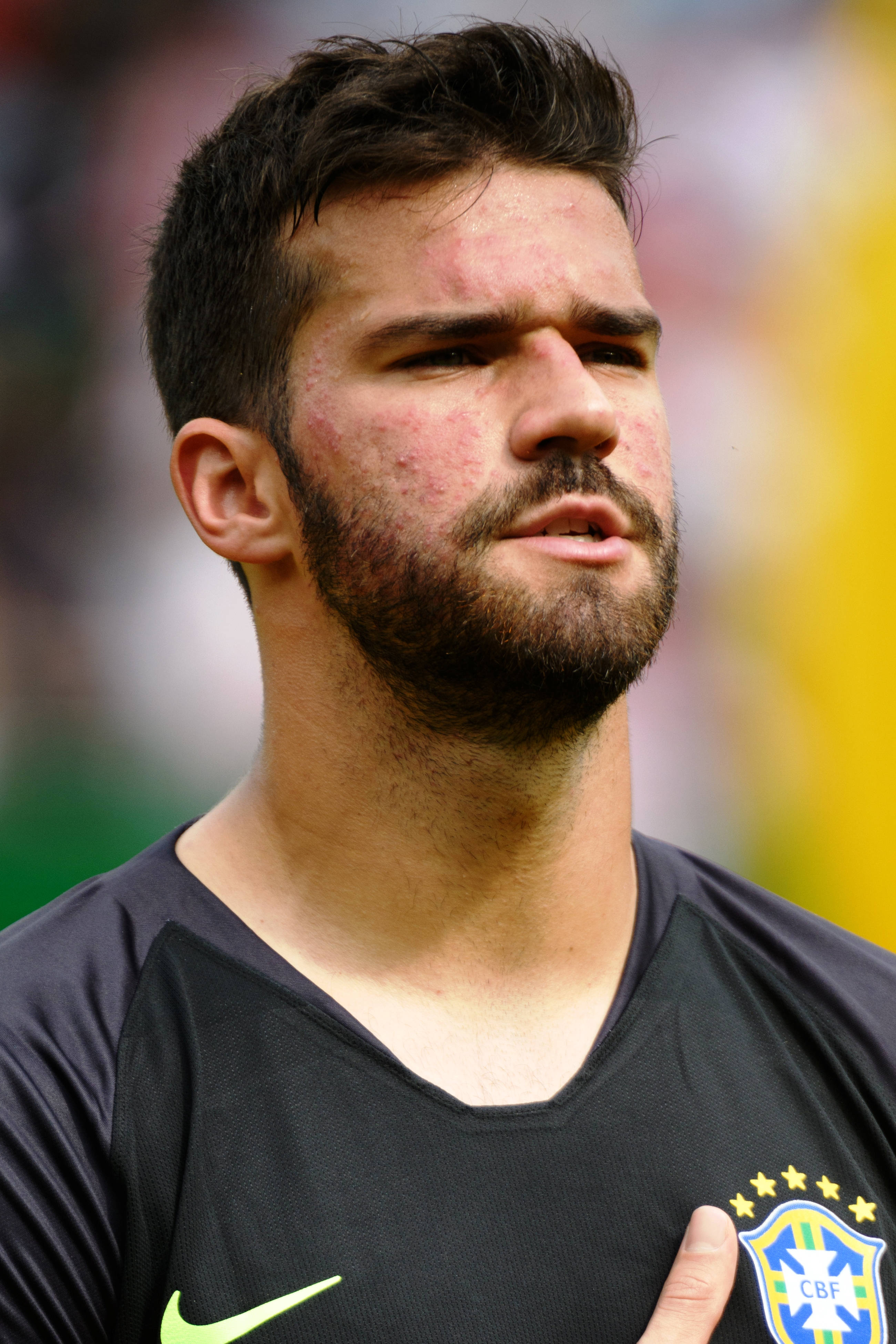 Alisson Becker nærprofil Bakgrunner